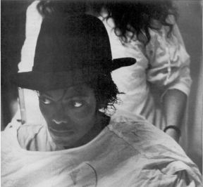 MJ is released from the hospital with a fedora covering his wound, 1984